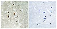IκB-β (phospho Thr19) Polyclonal Antibody