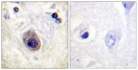 Connexin 43 (phospho Ser261) Polyclonal Antibody