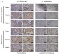 Cortactin (phospho Tyr421) Polyclonal Antibody