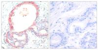 c-Rel (phospho Ser503) Polyclonal Antibody