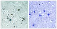 CRMP-2 (phospho Thr509) Polyclonal Antibody