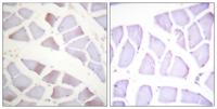 Crystallin-αB (phospho Ser19) Polyclonal Antibody
