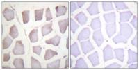 Crystallin-αB (phospho Ser59) Polyclonal Antibody