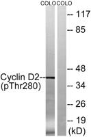 Cyclin D2 (phospho Thr280) Polyclonal Antibody