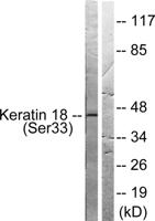 Cytokeratin 18 (phospho Ser33) Polyclonal Antibody