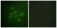 DAPK3 (phospho Thr265) Polyclonal Antibody