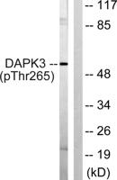 DAPK3 (phospho Thr265) Polyclonal Antibody