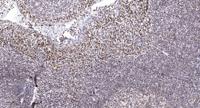 DAPK3 (phospho Thr265) Polyclonal Antibody