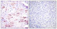 Daxx (phospho Ser668) Polyclonal Antibody