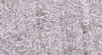 AP-1 (phospho Tyr170) Polyclonal Antibody