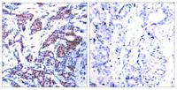 AP-1/Jun D (phospho Ser73/100) Polyclonal Antibody