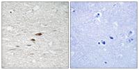 APC (phospho Ser2054) Polyclonal Antibody