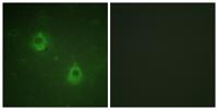APC1 (phospho Ser688) Polyclonal Antibody
