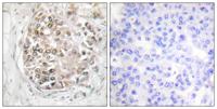 DNA-PKCS (phospho Ser2056) Polyclonal Antibody