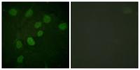 DNA-PKCS (phospho Thr2638) Polyclonal Antibody