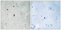 DNA-PKCS (phospho Thr2647) Polyclonal Antibody