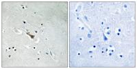 APLP2 (phospho Tyr755) Polyclonal Antibody