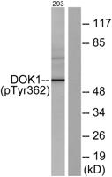 Dok-1 (phospho Tyr362) Polyclonal Antibody