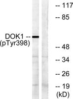 Dok-1 (phospho Tyr398) Polyclonal Antibody