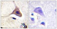 DOR-1 (phospho Ser363) Polyclonal Antibody