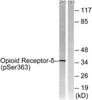 DOR-1 (phospho Ser363) Polyclonal Antibody