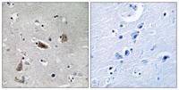 Doublecortin (phospho Ser339) Polyclonal Antibody