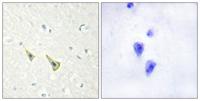 DREAM (phospho Ser63) Polyclonal Antibody