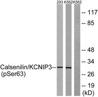 DREAM (phospho Ser63) Polyclonal Antibody