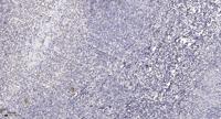 DRP1 (phospho Ser637) Polyclonal Antibody
