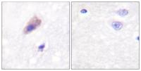 Dynamin I (phospho Ser774) Polyclonal Antibody