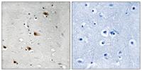 E2A (phospho Thr355) Polyclonal Antibody