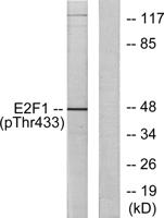 E2F-1 (phospho Thr433) Polyclonal Antibody