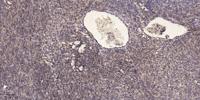 eEF2K (phospho Ser359) Polyclonal Antibody