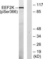 eEF2K (phospho Ser366) Polyclonal Antibody