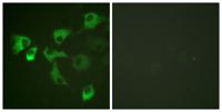 EF-2 (phospho Thr56) Polyclonal Antibody