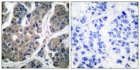 EF-2 (phospho Thr56) Polyclonal Antibody
