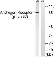 AR (phospho Tyr363) Polyclonal Antibody