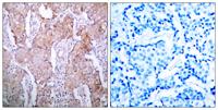 EGFR (phospho Ser1070) Polyclonal Antibody