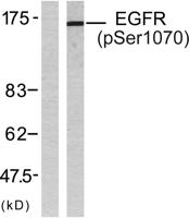 EGFR (phospho Ser1070) Polyclonal Antibody