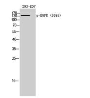 EGFR (phospho Ser695) Polyclonal Antibody