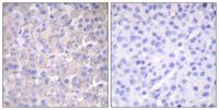 EGFR (phospho Thr693) Polyclonal Antibody