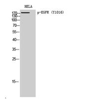 EGFR (phospho Tyr1016) Polyclonal Antibody