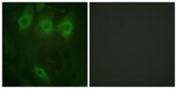 EGFR (phospho Tyr1016) Polyclonal Antibody