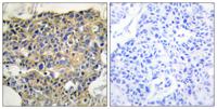 EGFR (phospho Tyr1016) Polyclonal Antibody