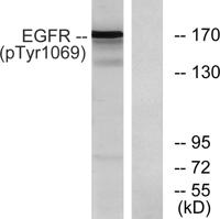 EGFR (phospho Tyr1069) Polyclonal Antibody