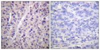 A-Raf (phospho Tyr302) Polyclonal Antibody