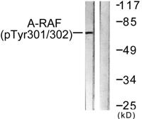 A-Raf (phospho Tyr302) Polyclonal Antibody