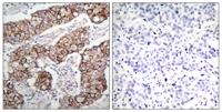 EGFR (phospho Tyr1092) Polyclonal Antibody