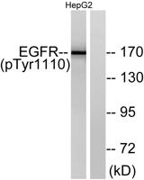 EGFR (phospho Tyr1110) Polyclonal Antibody