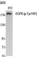 EGFR (phospho Tyr1197) Polyclonal Antibody
